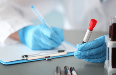 HPV DNA 2 genotypy wysokoonkogenne 16, 18 jakościowo