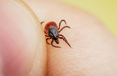 Lyme disease screening package